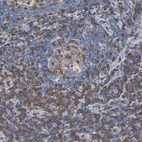 Immunohistochemical staining of human lymph node shows strong membranous positivity in lymphoid cells.