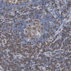 Anti-SH3KBP1 Antibody