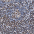Immunohistochemical staining of human lymph node shows strong membranous positivity in lymphoid cells.