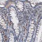 Immunohistochemical staining of human rectum shows strong membranous positivity in lymphoid cells.
