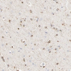 Immunohistochemical staining of human cerebral cortex shows strong membranous positivity in glial cells.