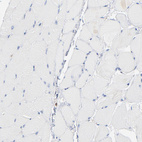 Immunohistochemical staining of human skeletal muscle shows no positivity in myocytes as expected.