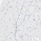 Immunohistochemical staining of human skeletal muscle shows no positivity in myocytes as expected.