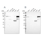 Western blot analysis using Anti-SH3KBP1 antibody HPA003351 (A) shows similar pattern to independent antibody HPA003355 (B).