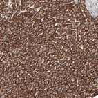 Anti-SLC16A2 Antibody