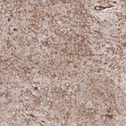 Immunohistochemical staining of human cerebral cortex shows moderate positivity.