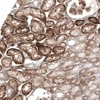 Immunohistochemical staining of human kidney shows strong positivity in cells in tubules.