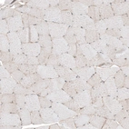 Immunohistochemical staining of human skeletal muscle shows weak positivity in striated muscle fibers.