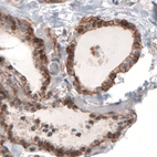 Immunohistochemical staining of human thyroid gland shows moderate to strong membranous positivity in glandular cells.