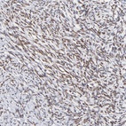 Anti-ZNF74 Antibody