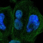 Immunofluorescent staining of human cell line A-431 shows localization to nucleoplasm & actin filaments.