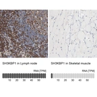 Anti-SH3KBP1 Antibody