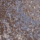 Immunohistochemical staining of human lymph node shows high expression.