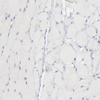 Immunohistochemical staining of human skeletal muscle shows low expression as expected.