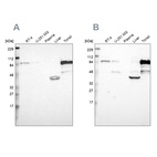 Western blot analysis using Anti-SH3KBP1 antibody HPA003355 (A) shows similar pattern to independent antibody HPA003351 (B).