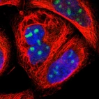 Immunofluorescent staining of human cell line A-431 shows localization to nucleoli.