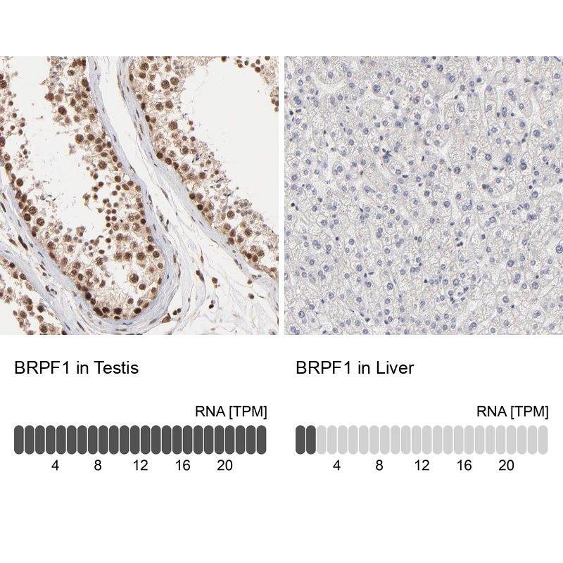 Anti-BRPF1 Antibody