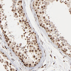 Immunohistochemical staining of human testis shows strong nuclear-cytoplasmic positivity in cells in seminiferous ducts.