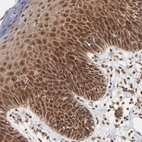 Immunohistochemical staining of human skin shows strong nuclear-cytoplasmic positivity in squamous epithelial cells.