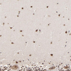 Immunohistochemical staining of human cerebellum shows strong nuclear positivity in molecular layer and moderate cytoplasmic positivity in purkinje cells.