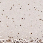 Immunohistochemical staining of human cerebellum shows strong nuclear positivity in molecular layer and moderate cytoplasmic positivity in purkinje cells.