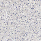Immunohistochemical staining of human liver shows no positivity in hepatocytes as expected.