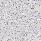 Immunohistochemical staining of human liver shows no positivity in hepatocytes as expected.