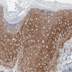Immunohistochemical staining of human skin shows moderate cytoplasmic positivity in epidermal cells.