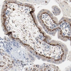 Immunohistochemical staining of human placenta shows moderate to strong cytoplasmic positivity in trophoblastic cells.