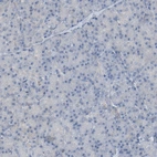 Immunohistochemical staining of human pancreas shows no cytoplasmic positivity in exocrine glandular cells as expected.