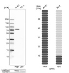 Western blot analysis in human cell lines A-431 and PC-3 using Anti-OPTN antibody. Corresponding OPTN RNA-seq data are presented for the same cell lines. Loading control: Anti-PPIB.