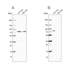 Anti-OPTN Antibody