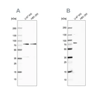 Western blot analysis using Anti-OPTN antibody HPA003360 (A) shows similar pattern to independent antibody HPA003279 (B).