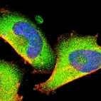 Immunofluorescent staining of human cell line U-251 MG shows localization to cytosol.