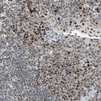 Immunohistochemical staining of human tonsil shows strong nuclear positivity in non-germinal center cells.