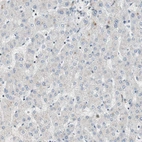 Immunohistochemical staining of human liver shows no nuclear positivity in hepatocytes as expected.