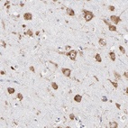 Anti-RPL3 Antibody