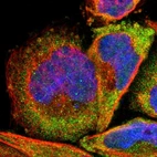 Immunofluorescent staining of human cell line A-431 shows localization to cytosol.