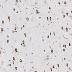 Anti-RPLP1 Antibody