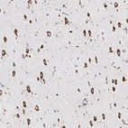 Anti-RPLP1 Antibody