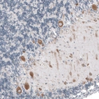 Immunohistochemical staining of human cerebellum shows moderate cytoplasmic positivity in Purkinje cells.