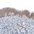 Immunohistochemical staining of human skin shows moderate cytoplasmic positivity in epidermal cells.