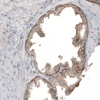 Immunohistochemical staining of human prostate shows moderate cytoplasmic positivity in glandular cells.