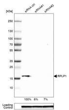 Western blot analysis in HeLa cells transfected with control siRNA, target specific siRNA probe #1 and #2, using Anti-RPLP1 antibody. Remaining relative intensity is presented. Loading control: Anti-GAPDH.