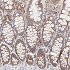 Immunohistochemical staining of human gastrointestinal shows moderate cytoplasmic positivity in glandular cells.