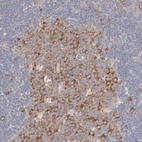 Immunohistochemical staining of human lymph node shows moderate cytoplasmic positivity in germinal center cells.
