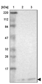 Lane 1: Marker [kDa] 220, 112, 84, 47, 32, 26, 17_br/_Lane 2: Human cell line RT-4_br/_Lane 3: Human cell line U-251MG sp