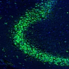 Immunofluorescence staining of mouse hippocampus shows positivity in neurons in CA3 pyramidal cell layer.