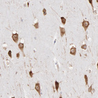 Anti-RPL9 Antibody