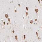 Immunohistochemical staining of human hippocampus shows moderate positivity in neurons.